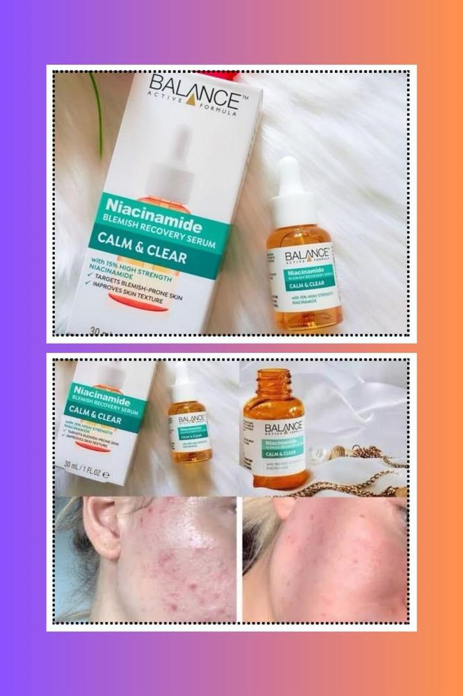 Niacinamide Serum 30ml Blemish Removal for Oily Skin